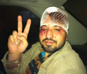 سیدشهاب الدین واجدی پس از مجروح شدن توسط سبزها
